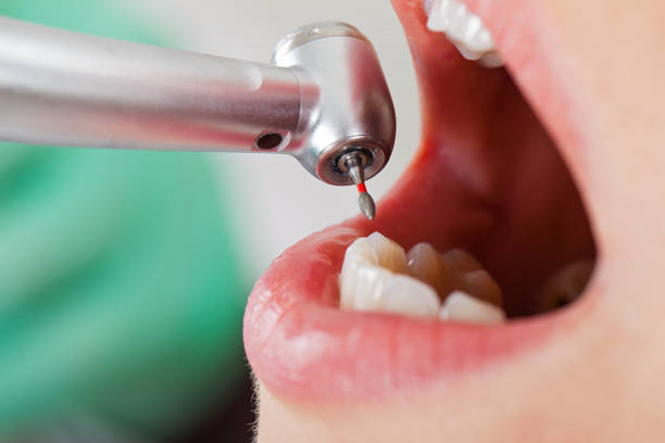 Best Emergency Tooth Extraction in Pioneer Village, KY